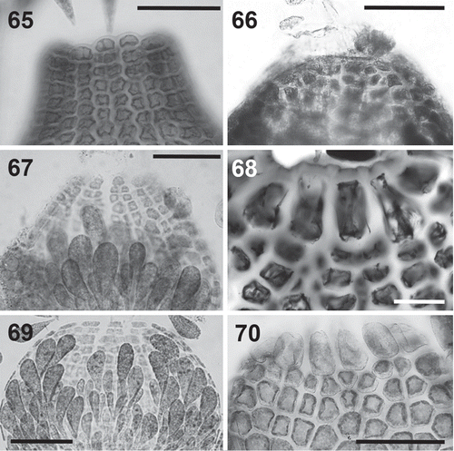 Figs 65–70. Cells surrounding the ostiole in the Polysiphonieae. Similar or slightly larger than the cells of the pericarp inmediately below in Polysiphonia stricta (Fig. 65, Polysiphonia sensu stricto clade 1), Vertebrata lanosa (Fig. 66, Vertebrata clade), P. denudata (Fig. 67, Carradoriella clade), and P. schneideri (Fig. 69, ‘P.’ schneideri clade). They are much larger in Streblocladia glomerulata (Fig. 68, Streblocladia clade) and Neosiphonia collabens (Fig. 70, Melanothamnus clade). Scale bars: Figs 65–68 and 70, 100 µm; Fig. 69, 60 µm.