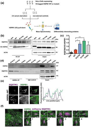 Figure 4. HSPB1 interacts with SQSTM1. (a) Design of the proteomics analysis. (b) Co-immunoprecipitation analysis of HSPB1 followed by western blotting of SQSTM1 in HeLa cells expressing GFP or V5-Tagged WT HSPB1 or mutant (R127W, S135F, P182L). (c) Quantification of the mean gray values of SQSTM1 affinity isolation normalized to HSPB1 levels from 3 different western blotting experiments of V5-HSPB1 immunoprecipitation. One-way ANOVA, with Tukey’s correction range test. Error bars = mean S.D, * = p < 0.05, *** = p < 0.001. (d) Co-immunoprecipitation analysis of HSPB1 followed by western blotting of SQSTM1 in lymphoblasts derived from patients carrying the HSPB1 mutations R127W or P182L and from a healthy control. (e) HeLa cells transduced with wild-type (WT) HSPB1 were immunostained for SQSTM1 and HSPB1. Representative images of the different channels are shown. The box shows the position of the zoomed region. The fluorescence intensity along the indicated line is plotted. Scale bar: 5 µm. AU, arbitrary units. (f) HeLa cells transduced with a lentivirus encoding wild-type HSPB1 and transfected with a plasmid encoding mCherry-SQSTM1 (magenta) were immunostained HSPB1 (green) and processed for expansion microscopy. The overview image is the summed projection of a z-stack of the expanded sample and for each indicated boxed region the XY, YZ and XZ planes are shown. Boxed regions with a SQSTM1/p62 body in the center were selected and the arrowheads indicate the position of cut through the different planes. Scale bar: 2 µm in the expanded sample, which corresponds to a size of approximately 500 nm.