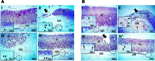 Figure 8 Histochemical staining of glandular stomach of rats with toluidine blue stain following (A) concurrent induction and treatment regimen and (B) post-treatment regimen.Notes: (I) Normal control group, (II) positive control group, (III) free APO treated group, and (IV) APO-loaded COS-NPs (F4) treated group. Oral dose of free or loaded APO was 14 mg/kg. Thick black arrows point to mucosal damage. Thin black arrows in insert point to mast cells. Thin red arrows point to leukocytic cells' infiltration. Toluidine blue stain, 100× and insert 200×.Abbreviations: APO, apocynin; COS, chitosan oligosaccharide; M, mucosa; NPs, nanoparticles; SM, submucosa.