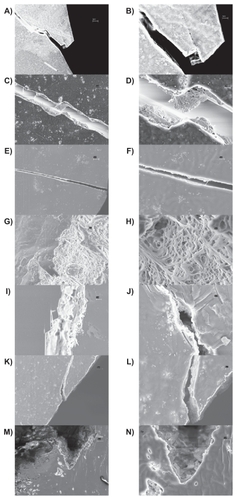 Figure 8 SE M images of bone cements fractured in tension [Left: 5K X (scale bar = 3 μm), Right: 15K X (scale bar = 1 μm)]: Plain (A, B), ZM (containing micron particulate ZrO2) (C, D), ZN (containing unfunctionalized ZrO2 nano-particles) (E, F), ZNFT (containing functionalized ZrO2 nano-particles) (G, H), BM (containing micron particulate BaSO4) (I, J), BN (containing unfunctionalized BaSO4 nano-particles) (K, L), and BNFT (containing functionalized BaSO4 nano-particles) (M, N).