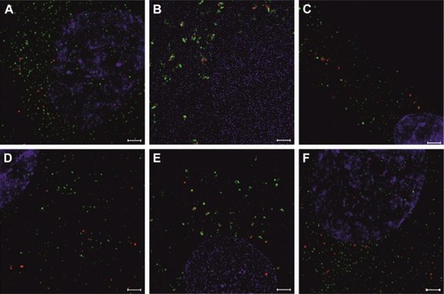 Figure 8 The SR-SIM analysis of hBM-MSCs, 24 hours after their co-culture with EVs previously stained with different dyes.Notes: EVs labeled with PKH26 (A–C) or tagged with Molday ION (D–F) (red) taken up by hBM-MSCs are visible inside the cells. Coexpression of tetraspanins: CD9 (A and D), CD63 (B and E), and CD81 (C and F) (green) were demonstrated. Cell nuclei were stained with Hoechst (blue). Scale bar =20 μm.Abbreviations: EVs, extracellular vesicles; hBM-MSCs, human bone marrow mesenchymal stem cells; SR-SIM, super-resolution structured illumination microscopy.