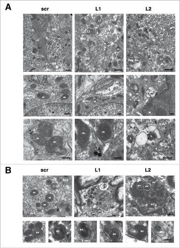 Figure 4. CMA deficiency results in accumulation of intracellular SNCA+ immunogold particles and autophagic vacuoles within transduced degenerating nigral neurons. (A) Electron micrographs demonstrating the intracellular distribution of SNCA immunolabeling in SNpc neurons transduced with Lamp2a-shRNA rAAVs. In both L1- and L2-injected animals, SNCA-conjugated silver enhanced immunogold particles (arrows) were found in the cytoplasm (upper row), in close proximity to endoplasmic reticulum (ER), mitochondria (m) and lysosomes (L) (middle and bottom rows). No cytoplasmic SNCA immunolabeling was evident in scr-injected animals, where SNCA was localized mainly in presynaptiC-terminals (S, bottom row). The cytoplasm of LAMP2A-deficient rats was also characterized by the presence of lipofuscin pigments (Lf) and autophagic vacuoles (av). N, nucleus; G, Golgi; mvb, multivesicular bodies; S, synapse; dspine, dendritic spine; Deg. Ax., degrading axon. Scale bars: 0.5 μm (upper row); 0.2 μm (middle row); 0.2 μm (bottom row). (B) Electron micrographs demonstrating the accumulation of numerous autophagosomes (av) with storage material of different nature and also multivesicular bodies (mvb), in degenerating neurites of LAMP2A-deficient rats (L1, L2). In contrast, nigral neurons of control scr-injected rats displayed typical dendrites (D) with intact mitochondria (m) and axonal terminal buttons (At1,2). A cluster of SNCA-conjugated gold/silver particles (arrow) was detectable in neighboring synaptic processes (S) of scr-injected animals, while SNCA-immunolabeling was present in dystrophic neurites in L1- and L2-injected animals (arrows, upper row). Scale bars: 0.2 μm (upper row); 0.1 μm (bottom row).
