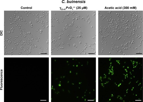 Figure 8 Images of detection of metacaspase activity assay of Candida buinensis cells after treatment with γ33-41PνD1++ (25 µM) for 24 hours. Control cells and cells treated with γ33-41PvD1++ were incubated with CaspACE FITC-VAD-FMK probe. Positive control cells were treated with 300 mM acetic acid and analyzed by fluorescence microscopy. Bars =20 µm.Abbreviation: DIC, differential interference contrast.