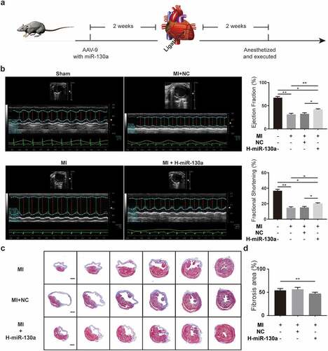 Figure 3. AAV-9 transfection and measurement of cardiac function and cardiac fibrosis area. (a) Experimental procedure and timeline of surgery and transfection of AAV-9. (b) Cardiac function quantification on day 14 post-MI, as determined with echocardiography (n = 6 per group). (c-d) Measurement of fibrosis area 2 weeks post-MI, as determined with Masson’s trichrome method (n = 6 per group, bar = 500 μm).