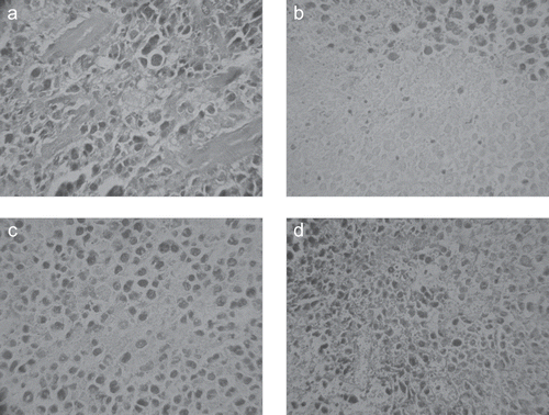 Figure 2.  Pathology sections of tumour tissues of the experimental mice (×200). (a) The control group; (b) The CTX treatment group; (c) PHB-P1 (30 mg/kg b.w.) treatment group; (d) PHB-P1 (60 mg/kg b.w.) treatment group.