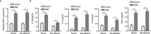 Figure 1. NEAT1 and inflammation levels are elevated in OME