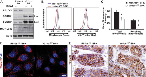 Figure 2. Rb1cc1 deletion reduces mitochondrial mass in BPK mammary tumors. (a) Immuno-blots showing levels of RB1CC1, SQSTM1, MAP1LC3B and ACTB in BPK primary cells with Rb1cc1F/+ or rb1cc1F/F. Cells were treated with HBSS ± bafilomycin A1 at 200 nM for 2 h before harvesting lysates. On the right, low indicates lower exposure time and high indicates higher exposure time of the same blot. (b) Histograms showing the distribution of BPK primary cells stained with MitoTracker Green or MitoTracker Red and analyzed by flow cytometry. (c) Quantification of the mean fluorescence intensities of BPK primary cells stained with MitoTracker Green or MitoTracker Red. Data represent the average of n = 4 tumors for Rb1cc1F/+ and rb1cc1F/F cohorts. Statistical significance was determined by two-tailed t-test, * denotes p ≤ 0.05. (d) Representative images of BPK primary cells with Rb1cc1F/+ or rb1cc1F/F alleles that were immuno-fluorescently labeled for TOMM20 and analyzed via confocal microscopy. Scale bar: 10 μm. (e) Representative images of BPK tumors with Rb1cc1F/+ or rb1cc1F/F alleles that were immuno-stained for TOMM20. Scale bar: 200 μm.