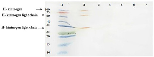 Figure 1 Western blot analysis of ferritin-binding proteins in S. pneumoniae. 1, protein marker; 2, plasma sample with 3 ferritin-binding proteins in ~30, 58 and 114 KDa ranges; 3, serum sample without any positive reaction; 4, a negative reaction with proteins concentrated from supernatant of S.pneumoniae culture; 5, a negative reaction with proteins from sediment of S.pneumoniae culture; 6, a negative reaction with reduced and denatured proteins concentrated from supernatant of S.pneumoniae culture; 7, a negative reaction with reduced and denatured proteins purified from sediment of S.pneumoniae culture.