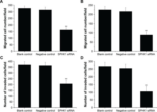 Figure 5 Effect of SPHK1 knockdown by siRNA on the migration and invasion of SH-SY5Y and SK-N-SH cells. Analysis of migration capability of SH-SY5Y (A) and SK-N-SH (B) cells. Analysis of invasion capability of SH-SY5Y (C) and SK-N-SH (D) cells.