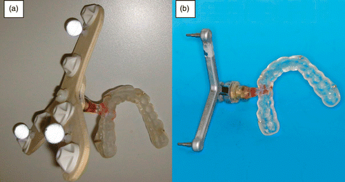 Figure 1. Dental splint (a) attached with a screw thread to a 3D polyethylene body carrying six fiducial markers for registration close to the lateral skull base, and (b) attached, again with a screw-thread, to the reference array intended to carry passive reflecting balls for referencing during navigation.