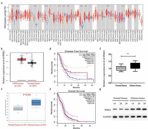 Figure 1. IP6K2 exhibited high expression in glioma tissues A Analyze the expression level of IP6K2 in a variety of tumors through the TIMER2.0 database; B Analyze the expression of IP6K2 in 163 glioma tissues and 207 normal tissues through the TCGA database; C Analyze the expression of IP6K2 in 23 glial tissues through the Oncomine database The expression of tumor tissue and 81 normal tissues; D Analyze the correlation between IP6K2 expression and the overall survival rate (OS) of glioma patients through TCGA database; E Analyze the relationship between IP6K2 expression level and disease-free survival of glioma patients through TCGA database (DFS) correlation; F Detected the mRNA expression of IP6K2 in glioma tissues and normal control tissues by RT-PCR assay; G Detected the protein expression of IP6K2 in glioma tissues and normal control tissues by Western blot assay. *p < 0.05; ** p < 0.01; *** p < 0.001.