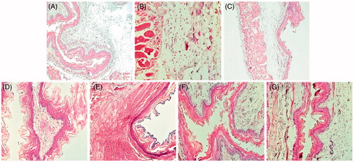 Figure 2. Esophageal histology showing the protective effects of MBSAE, famotidine (FAM) and gallic acid (GA) on ER-induced histological changes in esophagus. Animals were treated with various doses of MBSAE (25, 50 and 100 mg/kg, p.o.), FAM (20 mg/kg, b.w., p.o.), GA (50 mg/kg, p.o.) or vehicle (H2O) during 6 h after ER induction. (A) Control; (B) ER; (C, D and E) ER + MBSAE (25, 50 and 100 mg/kg, p.o., respectively; (F) ER + FAM (20 mg/kg, b.w., p.o.); (G) ER + GA (50 mg/kg, p.o.).