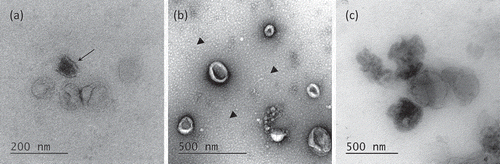 Figure 3. Transmission Electron Microscopy of EVs. (a) Morphology of OptiprepTM density gradient isolated EVs. Some vesicles are more electron-dense (arrow). (b) EVs purified by simple ultracentrifugation appear flattened. A layer of globular lipids was noticed in the background (arrow heads). (c) EVs aggregates were observed independently of the isolation protocols used.