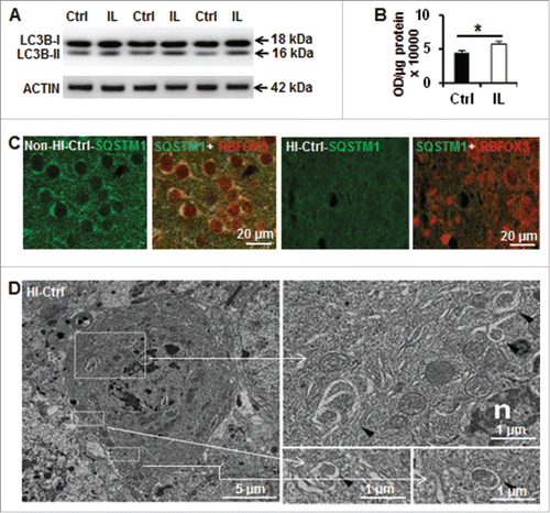 Figure 1. Hypoxia-ischemia induces neuronal autophagy in neonatal Atg7flox/+; Nes-Cre mice. (A) Representative immunoblotting of LC3B in Ctrl (Atg7flox/+; Nes-Cre) mice and (B) its corresponding quantification showed that LC3B-II (16 kDa) was increased in the ipsilateral hemisphere (IL) 24 h after HI compared to an uninjured control brain, (*, P < 0.05, n = 6). (C) Immunostaining of SQSTM1 in the cortex of Ctrl mice suggesting a decrease of its staining in neurons (RBFOX3) 24 h after HI. (D) Dying neurons in Ctrl mice exhibited increased electron density and nuclei with chromatin condensation. They possessed also typical autophagosomes with double membranes in the perikarya (black arrowheads) 24 h after HI. Squared areas are enlarged in the right panels.