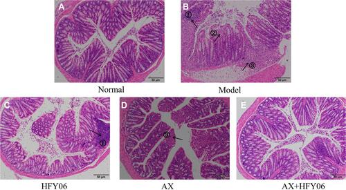 Figure 4 Effect of AX combine L. fermentum HFY06 supplementation on H&E pathological of colon tissue in mice ((A) Normal, (B) Model, (C) L. fermentum HFY06, (D) AX, (E) L. fermentum HFY06 combined with AX). HFY06: 2.5% DSS with L. fermentum HFY06 (1.0 × 1010 CFU), AX: 2.5%DSS with AX (200 mg/kg), AX+HFY06: 2.5% DSS with AX (200 mg/kg) and L. fermentum HFY06 (1.0 × 1010 CFU). Arrow 1 indicates inflammatory cell infiltration, arrow 2 indicates a reduction in goblet cells, and arrow 3 indicates colonic mucosal erosion.