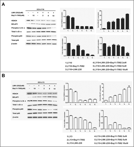 Figure 5 Down-regulation of HDAC4-induced upregulation of BCLAF1 was mediated through inhibition of NF-kB activity. Western blot detected the protein expression of HDAC4, BCLAF1, phosphorylated P65 and total P65, phosphorylated IκB-αS32 / S36 and total IκB-α. Western blot bands were quantified with Quantity One software. All experiments were repeated three times.