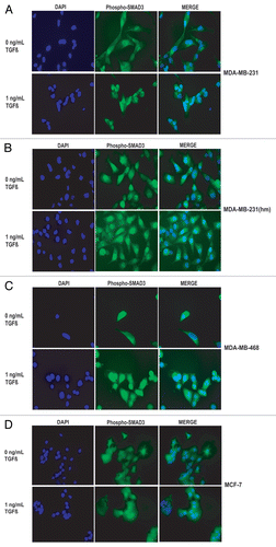 Figure 5 Effect of TGFβ-1 on phospho-SMAD3 translocation to the nuclei in various breast cancer cell lines. Serum starved breast cancer cells were untreated or treated with 1 ng/ml TGFβ1 for 60 minutes before immunofluorescent staining with phospho-SMAD3 antibody. Nuclei were counterstained with DAPI.