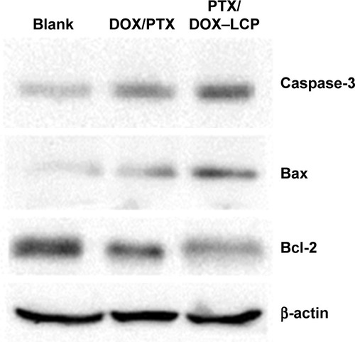 Figure 10 Images of Bax, Bcl-2, and Caspase-3 protein expression levels of the blank, DOX/PTX, and PTX/DOX–LCP groups.Abbreviations: LCP, lipid-coated hollow calcium phosphate; DOX, doxorubicin; PTX, paclitaxel.