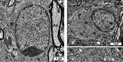 Figure 17. TEM of Interfibrillar oligodendrocytes of the ODS48h murine thalamus revealing an active, euchromatic aspect of organelles, including smooth and rough endoplasmic reticulum and large Golgi apparatus (G). In both A and B, the huge nucleus, adjacent to cross-, oblique and parasagittal axonal sections; astrocyte (As), and nerve cell body (N) with small damaged axon’s myelin (stars). In B: cell adjacent to a few remyelinated narrow axons (plain white arrows) with imperfections or other damages (stars); thickened contacts with astrocyte (As) (open white arrows), detected by cytoskeletal glial fibrillar proteins and glycogen storages (small white arrows). C: Enlarged part of an oligodendrocyte cytoplasm revealing abundant microtubules and cytoskeleton amongst polyribosomes, RER, and Golgi apparatus (G)