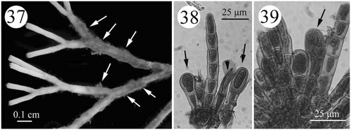 Figs. 37–39. Development of tetrasporangial structures in Actinotrichia taiwanica sp. nov. (#SLL CP-05-11-2002-1). Fig. 37. Branches showing the assimilatory filaments (arrows) where the tetrasporangia are borne. Fig. 38. Young tetrasporangia (arrows) produced terminally from the assimilatory filaments. Fig. 39. Mature tetrasporangia dividing in a cruciate manner (arrow).