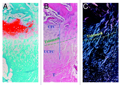 Figure 1. Histological features of the fibrocartilaginous bone-tendon interface stained with (A) Safranin-O, (B) H&E, and viewed with (C) polarized light microscopy. Note the four zones of the native enthesis. Magnification 20×. B, bone; CFC, calcified fibrocartilage; UFC, uncalcified fibrocartilage; T, tendon. Reproduced with permission from reference Citation122.