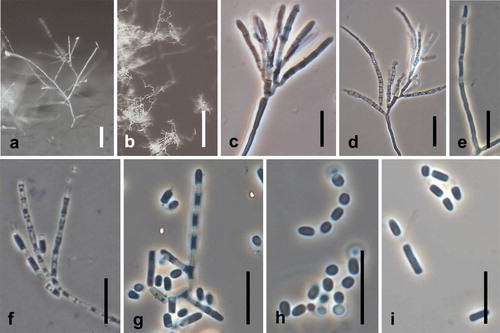 Fig. 10. Spiromastix kosraensis. Ex-type culture on MEA. A, B. Aerial conidiophores. C–G. Conidiophores and conidia. H, I. Terminal and single lateral conidia and arthroconidia. Bars: A = 50 μm, B = 100 μm, C–I = 10 μm.