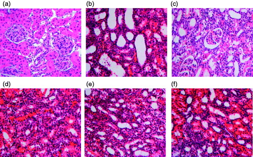 Figure 4. Effect of resveratrol on rat renal tubular damage index. The tissue sections from different groups were stained with HE staining and observed under light microscope at 400× magnification. Panel a represents sham group; panel B represents model group; panel c represents enalapril group; panel d represents high-dose resveratrol group; panel e represents middle-dose resveratrol group and panel f represents low-dose resveratrol group.