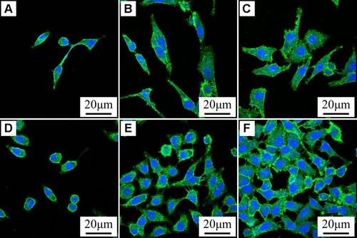 Figure 9 CLSM images of morphologies of GE cells on PEEK (A and D), 80FPK (B and E) and 160FPK (C and F) at 12 (A–C) and 24 (D–F) hours after culturing.