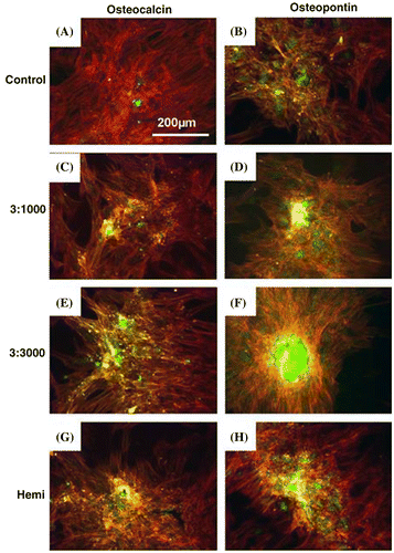 Figure 5. Osteocalcin (OCN) and osteopontin (OPN) fluorescence images of HMSCs cultured on control and test materials. Cells on planar control formed confluent layers but very little OCN or OPN stained was observed on day 21. Bone nodule formation can be seen on 3:1000. (Note: red = actin, green = OCN/OPN). Images reproduced with permission from [Citation47].