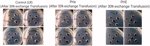 Figure 7. Ouchterlony double diffusion test on rats after 30% blood volume exchange transfusion with control (LR), PHe, or PHE (4 rats/group)) showing no antigen-antibody precipitations.