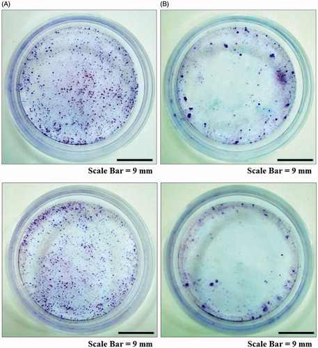Figure 12. Colony formation assay of cancer cell lines. AMJ-13 cell line (upper lane) and MCF-7 cell line (lower lane). (A) Non-treated cells, (B) Cells treated with MNPs synthesized by leaf extract of Albizia adianthifolia.