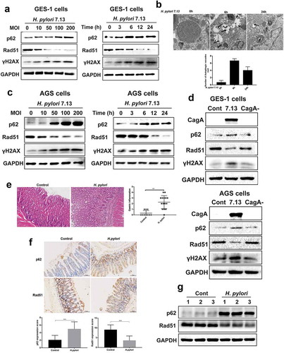 Figure 5. H. pylori-Susceptible DNA damage response and autophagy are shared between different bacterial strains, cell types and animal models. (a) Representative images of Western blot analysis for p62, Rad51 and γH2AX in GES-1 cells infected with H. pylori 7.13 at different MOI or at different time points. (b) Transmission electron microscopy for autophagic vacuoles in gastric cells infected with H. pylori 7.13. Scale bar: 500 μm. (c, d) Representative images of Western blot analysis for CagA, p62, Rad51 and γH2AX in gastric cells (c) GES-1, or (d) AGS infected with H. pylori strain 7.13 or its CagA-knockout mutant. (e) H&E staining for gastric pathology in gastric tissues of H. pylori-infected C57BL/6 mice. (f) Immunohistochemistry staining for Rad51 and p62 levels in C57BL/6 mice infected with H. pylori. Scale bar: 50 μm. (g) Western blot analysis for Rad51 and p62 protein levels in gastric tissues of H. pylori-infected mouse model. Images are representative of n = 3 mouse stomachs. All in vitro experiments were independently repeated three or more times. **P < .01, ***P < .001.