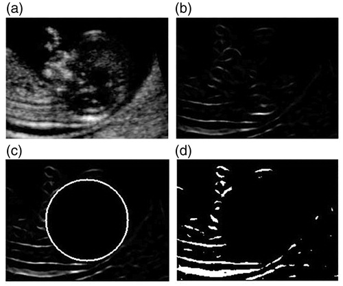 Figure 2. The results of the Hessian-based plate filter. (a) The sagittal plane of the original 3D data. (b) The sagittal plane of the filtered data. (c) The filtered data cleaned up according to the spatial constraints of the fetal head and the NT region. (d) The binary cleaned filtered data.