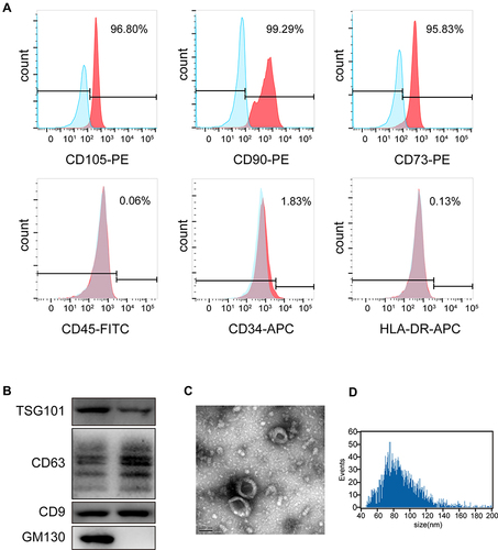 Figure 1 Characterization of iMSC and iMSC-sEVs. (A) Surface antigen profile of iMSC evaluated by flow cytometry. (B) Western blotting showing the expression of exosomal markers including CD9, TSG101, and CD63 in iMSC-sEVs, but not the negative marker GM130. (C) Representative image of iMSC-sEVs observed by TEM. Scale bar = 100 nm. (D) Particle size distribution of iMSC-sEVs measured by nano-flow cytometer.