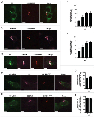 Figure 3. Intracellular S. aureus induces selective autophagy. (A) NIH/3T3 cells were infected with SH1000-RFP. Three hpi cells were fixed, stained with anti-ubiquitin and analyzed by confocal microscopy. Scale bars: 10 µm. (B) Quantification of the experiment shown in (A) for 1, 2, 3 and 4 hpi. The percentage of intracellular S. aureus colocalizing with ubiquitin is depicted. 100 cells per time point were analyzed. Data are represented as mean ± SEM of 3 independent experiments. (C) NIH/3T3 cells were infected with SH1000-RFP. Two hpi cells were fixed, stained with anti-SQSTM1 and analyzed by confocal microscopy. Scale bars: 12 µm. (D) Quantification of the experiment shown in (C) for 1, 2, 3 and 4 hpi. The percentage of intracellular S. aureus colocalizing with SQSTM1 is shown. 100 cells per time point were analyzed. Data are represented as mean ± SEM of 3 independent experiments. (E) NIH/3T3 cells were infected with SH1000-RFP. Two hpi cells were fixed, stained with anti-ubiquitin as well as anti-SQSTM1 and analyzed by confocal microscopy. Scale bars: 6 µm. (F) NIH/3T3 GFP-LC3B cells were infected with SH1000-RFP. Three and 4 hpi cells were fixed, stained with anti-ubiquitin and analyzed by confocal microscopy. Scale bars: 10 µm. (G) Quantification of the experiment shown in (F), visualized is the colocalization of GFP-LC3B-positive S. aureus with ubiquitin 3 and 4 hpi. 50 cells per time point were analyzed. Data are represented as mean ± SEM of 3 independent experiments. (H) NIH/3T3 GFP-LC3B cells were infected with SH1000-RFP. Three and 4 hpi cells were fixed, stained with anti-SQSTM1 and analyzed by confocal microscopy. Scale bars: 10 µm. (I) Quantification of the experiment shown in (H). Shown is the colocalization of GFP-positive S. aureus with SQSTM1 3 and 4 hpi. 50 cells per time point were analyzed. Data are represented as mean ± SEM of 3 independent experiments.