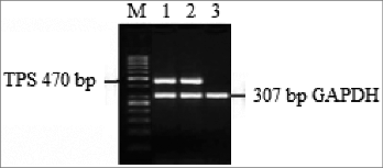 Figure 1. The results of RT-PCR for the A549-TPS specificity band. M: molecular marker; Lane 1: amplicon of transfected control DCs; Lane 2: amplicon of A549; Lane 3: amplicon of immature DCs.
