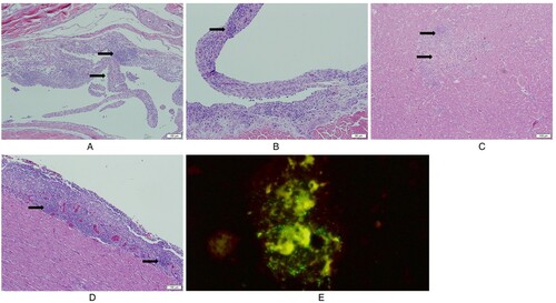 Figure 6. Histologic lesions in tendon, liver and heart. (A) Villous nodular synovial hyperplasia: the villous nodules include hyperplastic synoviocytes, lymphocytic infiltration and fibrosis; (B) Villous nodular hyperplasia with germinal centre-like lymphoid aggregates; (C) Hepatocellular necrosis with mononuclear cell infiltration; (D) Lymphocytic epicarditis; (E) Direct fluorescent antibody test (DFA) of positive liver and spleen samples of group inoculated with THRV2: QT-35 cells are displaying green fluorescence indicating THRV2 replication.