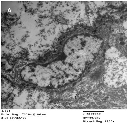 Figure 4. Representative micrographs of Transmission electron microscope of duodenum from broiler chickens treated with 20 mg AgNPs for 42 days showing nano particles of different size inside the nucleus (A) of the enterocyte.