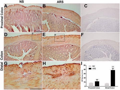 Figure 2. Effect of ARS on CRF immunoreactivities in proximal (A-B) and distal (D-E) colonic sections and quantification of CRF staining in NS and ARS-loaded rats (I). The ganglia in myenteric plexus of a NS (G) and ARS-loaded rat (H) are represented as the higher magnification of the boxed regions. Anti-CRF antibody was replaced by antibody diluent in negative controls (C, F). Scale bars represent 100 µm, n = 3 in all groups, p < .01 vs NS). NS: non-stressed, ARS: acute restraint stress for 90 min.