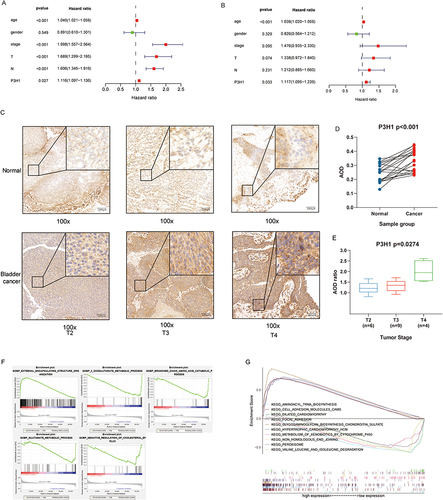 Figure 3 COX proportional hazards model, immunohistochemistry and gene set enrichment analysis. (A) Univariate COX proportional hazards model. (B) Multivariate COX proportional hazards model. (C) Expression of P3H1 in tissue samples with different T grades. (D) AOD difference analysis of immunohistochemistry staining between cancer tissues and paired adjacent tissues. (E) Distribution of AOD ratio between cancer tissue and paired adjacent tissue in patients with different T grades. (F) Gene enrichment analysis entries were performed for biological functions in the gene ontology database. (G) Gene enrichment analysis entries of key pathways in Kyoto encyclopedia of genes and genomes database were performed. AOD, average optical density.