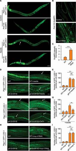 Figure 5. Epidermal structural damage inhibits the autophagy process via activation of calcium influx. (A) Representative confocal images showing the distribution patterns of epidermal GFP::LGG-1 puncta and GCaMP3 fluorescence in the adults with an intact epidermis (control) or a single wound caused by needle puncture. Arrows point to sites of wounding. Scale bar: 40 μm. (B) Representative confocal images showing the fluorescent levels of epidermal GCaMP3 in the animals treated with the empty vector L4440 (control) or mup-4 RNAi. Scale bar: 40 μm. (C) Quantification of the relative GCaMP3 fluorescence in the epidermis with the indicated treatments, corresponding to results in (B). n = 12 per condition. (D) Representative confocal images showing the distribution patterns of Plgg-1::GFP::LGG-1 puncta in wild-type (WT) or gtl-2(n2618) young adults treated with or without needle wounding. Arrows point to sites of wounding. Scale bar: 10 μm. (E) Quantification of the number of GFP::LGG-1 puncta per unit area in the epidermis with the indicated treatments, corresponding to results in (D). n ≥ 10 per condition. (F) Representative confocal images showing the distribution patterns of Plgg-1::GFP::LGG-1 puncta in wild-type (WT) or gtl-2(n2618) young adults soaked with CaCl2 or control solution for 1 h after needle wounding. Arrows point to sites of wounding. Scale bar: 10 μm. (G) Quantification of the number of GFP::LGG-1 puncta per unit area in the epidermis with the indicated treatments, corresponding to results in (F). n ≥ 7 per condition. (H) Representative confocal images showing the distribution patterns of Plgg-1::GFP::LGG-1 puncta in wild-type (WT) or gtl-2(n2618) young adults treated with or without mup-4 RNAi. Scale bar: 10 μm. (I) Quantification of the number of GFP::LGG-1 puncta per unit area in the epidermis with the indicated treatments, corresponding to results in (H). n ≥ 16 per condition. Error bars represent mean ± SEM. ns, not significant; **, P < 0.01; ***, P < 0.001; ****, P < 0.0001 (two-tailed, unpaired t-test).