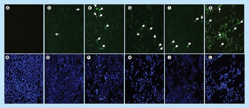 Figure 14. Analysis of Bax localization and expresssion in MCF-7 cells.Localization and expression of Bax in MCF-7 cells counterstained with DAPI. The results show (A & B) a negative control, no labeling is seen. (C–L) Micrographs show positive Bax staining in the nucleus and cytoplasm. MCF-7 cells show less expression of Bax in (C & D) untreated cells because apoptosis is inhibited in these cells, but the treatment with (E–H) arsenic trioxide upregulated the expression of this protein. The same trend was observed even in the positive controls, (I & J) cobalt chloride and (K & L) curcumin which also regulated the expression of Bax protein. White arrows point to mitotic cells with increased Bax staining levels. Magnification 20×.