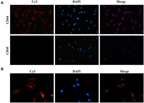 Figure 5 BMSCs identification and BMSCs Exos internalization. (A) Immunofluorescence assays showing expression levels of BMSCs surface markers (magnification, ×100); BMSCs, bone marrow-derived mesenchymal stem cells. (B) Uptake of Cy3-labeled BMSC-Exos by SONFH BMSCs.