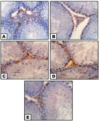 Figure 6. Photomicrograph of paraffin-embedded sections through the testes of control (a), neem (b), diabetic (c,d) and diabetic with neem (e) stained with anti-COX-2 antibody. Note: Weak to moderate immunoreactivity for COX-2 protein in groups (a) and (b), a strong positive reaction in (c) and (d) and moderate immune expression for COX-2 in group (e)