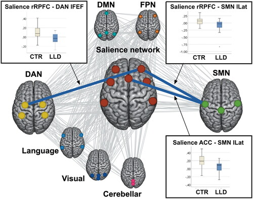 Figure 1. Functional connectivity differences between the groups. The functional connections that had significantly weaker strength in the LLD group than in the control group are shown in blue with the corresponding box plots. All the possible functional connections (19 x 32 correlations) that were assessed in the analysis are shown in the background as gray lines.