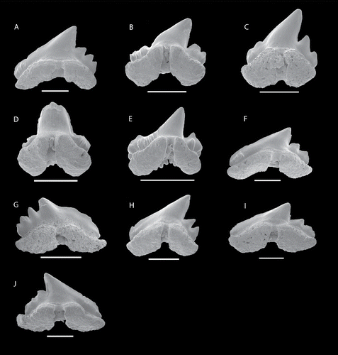 FIGURE 12. SEM images of Kallodentis rhytistemma, gen. et sp. nov., NRM-PZ P16202, A, linguobasal view; NRM-PZ P16137, B, linguobasal view; NRM-PZ P16144, C, linguobasal view; NRM-PZ P16141, D, linguobasal view; NRM-PZ P16139, E, linguobasal view; NRM-PZ P16192, F, linguobasal view; NRM-PZ P16194, G, linguobasal view; NRM-PZ P16186, H, linguobasal view; NRM-PZ P16205, I, linguobasal view; NRM-PZ P16182, J, linguobasal view. All scale bars equal 1 mm.