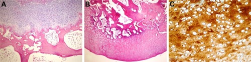 Figure 5 Histopathological appearance of cartilage formed in the HA+CS group.