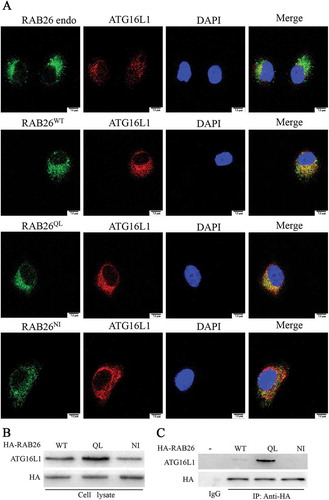 Figure 9. RAB26 interacts with ATG16L1 via its GTP-bound form. (a) HPMECs were transfected with the plasmids expressing GFP-tagged wild-type RAB26 (RAB26WT), or its mutants, GFP-tagged RAB26Q123L (RAB26QL) and GFP-tagged RAB26N177I (RAB26NI), and co-stained with anti-ATG16L1 (red). Scale bars, 7.5 µm. (b and c) HPMECs were transfected with the HA-tagged wild-type RAB26 (RAB26WT) or its mutants HA-tagged RAB26Q123L (RAB26QL) and HA-tagged RAB26N177I (RAB26NI), and lysates from cells were immunoprecipitated (IP) with HA antibodies and then immunoblotted with anti-ATG16L1 antibodies. endo, endogenous.