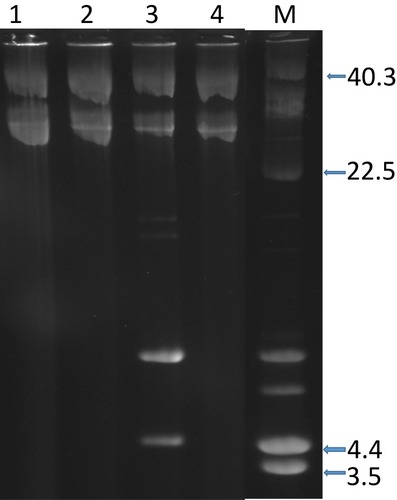 Figure 2 Plasmid content of representative CC15-MRSA-V+SCCfus isolates. Lanes 1, 2, and 4 contain single plasmid of c.28-kb. Lane 3, contains 2 plasmids of c.28-kb and 4.4-kb. Lane M, contains plasmid size markers. Sizes are in Kb.