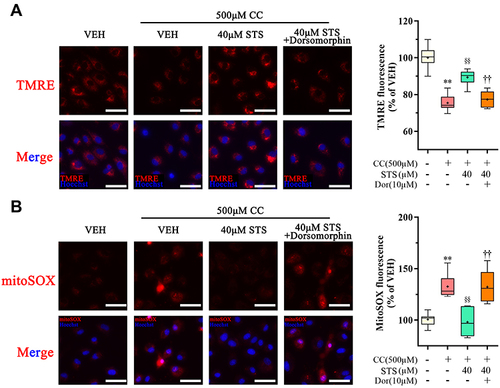 Figure 7 Inhibition of AMPK signaling eliminates the protective effect of Sodium tanshinone IIA sulfonate on cholesterol crystals-induced mitochondrial damage. HUVECs were incubated with 500 μM cholesterol crystals (CC) for 16 h and 40 μM Sodium tanshinone IIA sulfonate (STS) was added 1 h before CC treatment. 10 μM Dorsomorphin was added 2 h before STS treatment. (A) Representative images of TMRE staining in HUVECs that were stained with TMRE (red, to label MMP) and Hoechst 33342 (blue, to label nuclear). (B) HUVECs were stained with Mito-SOX probe (red, to label mtROS), Mito-tracker Green (green, to label mitochondrial) and Hoechst 33342 (blue, to label nuclear) and images were detected under Confocal High-Content Imaging System. Data are represented as mean ± SD of three independent replicates; **P < 0.01 vs VEH group; §§P < 0.01 vs cholesterol crystals group; ††P < 0.01 vs STS treatment group; Scale bar = 10 μm.